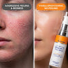 Vitamin C Face Serum 1.0 fl oz
